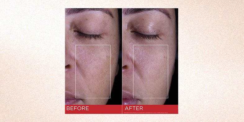 Before and after comparison